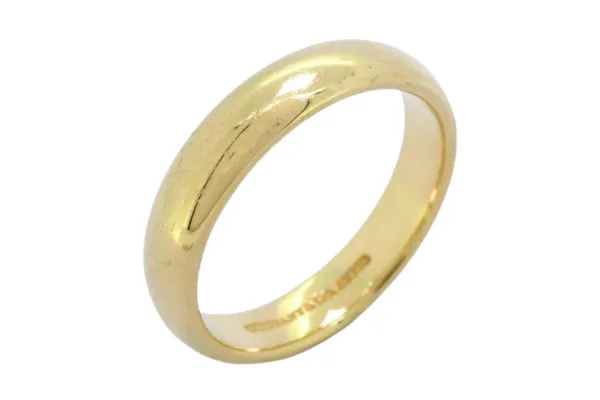 18金(K18)の結婚指輪をつけっぱなしにすると金属アレルギーは出る?