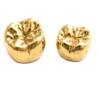 金歯<br>買取