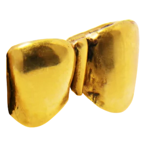 金歯